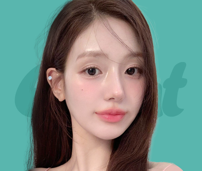 자연유착 눈매교정♡