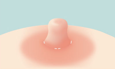 육안상 흉터 찾아볼 수 없음