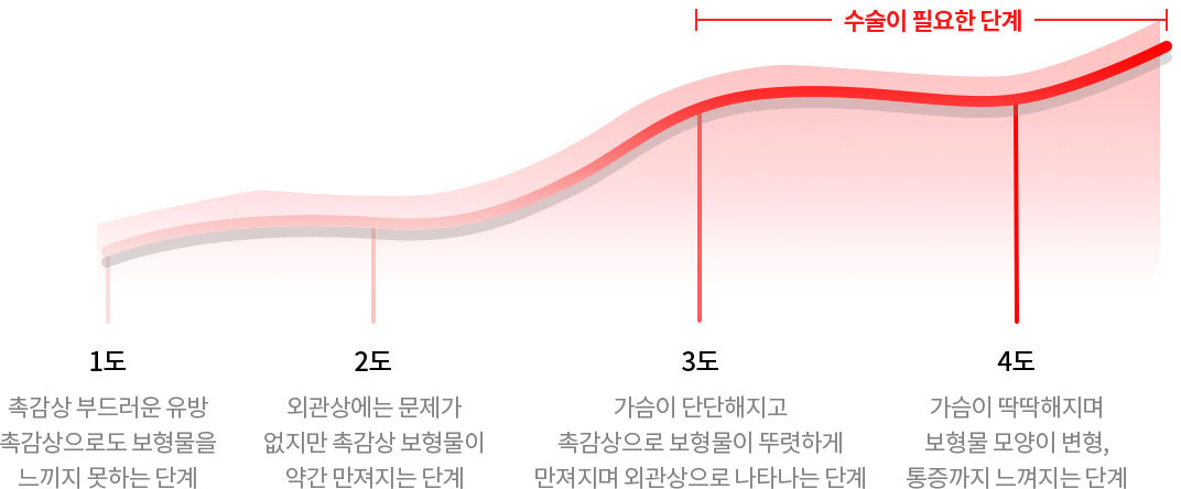 구형구축 단계별 증상
