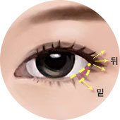 뒤트임과 밑트임을 동시에