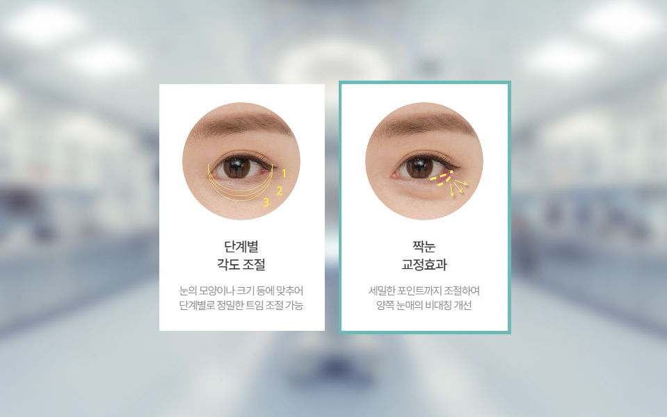나나성형외과의 밑트임