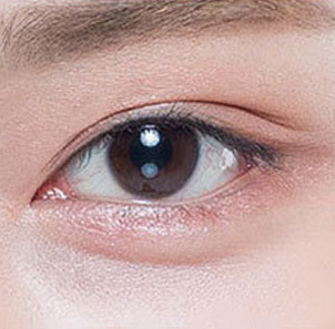 크고 또렷한 이상적인 눈매 완성