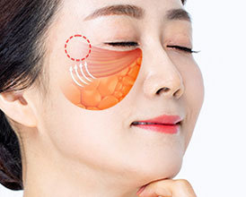 지방의 위치 또한 교정