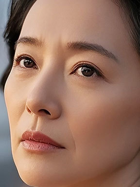 노안눈매 개선