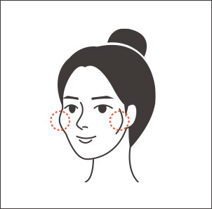 45도 측면에서 봤을 때 돌출이 심한 경우