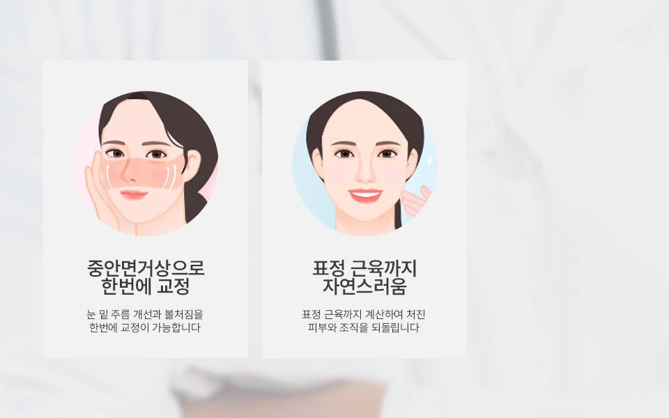 나나성형외과의 중안면거상술