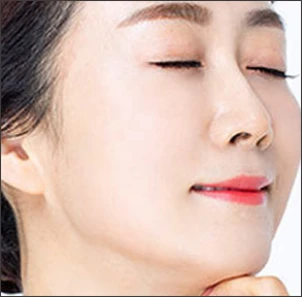 절개창 봉합