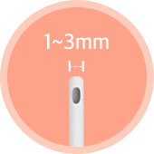 마이크로 캐뉼라