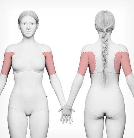 팔뚝 대용량 지방흡입