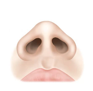 수면마취 후 부분 마취