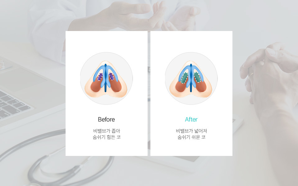 나나성형외과의 기능 코성형