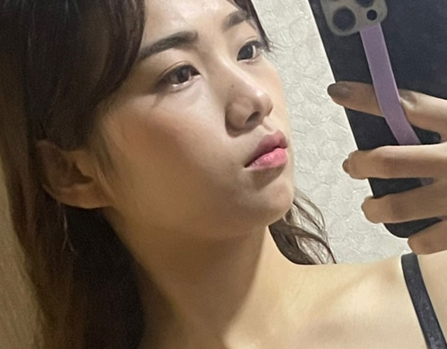 코 before이미지