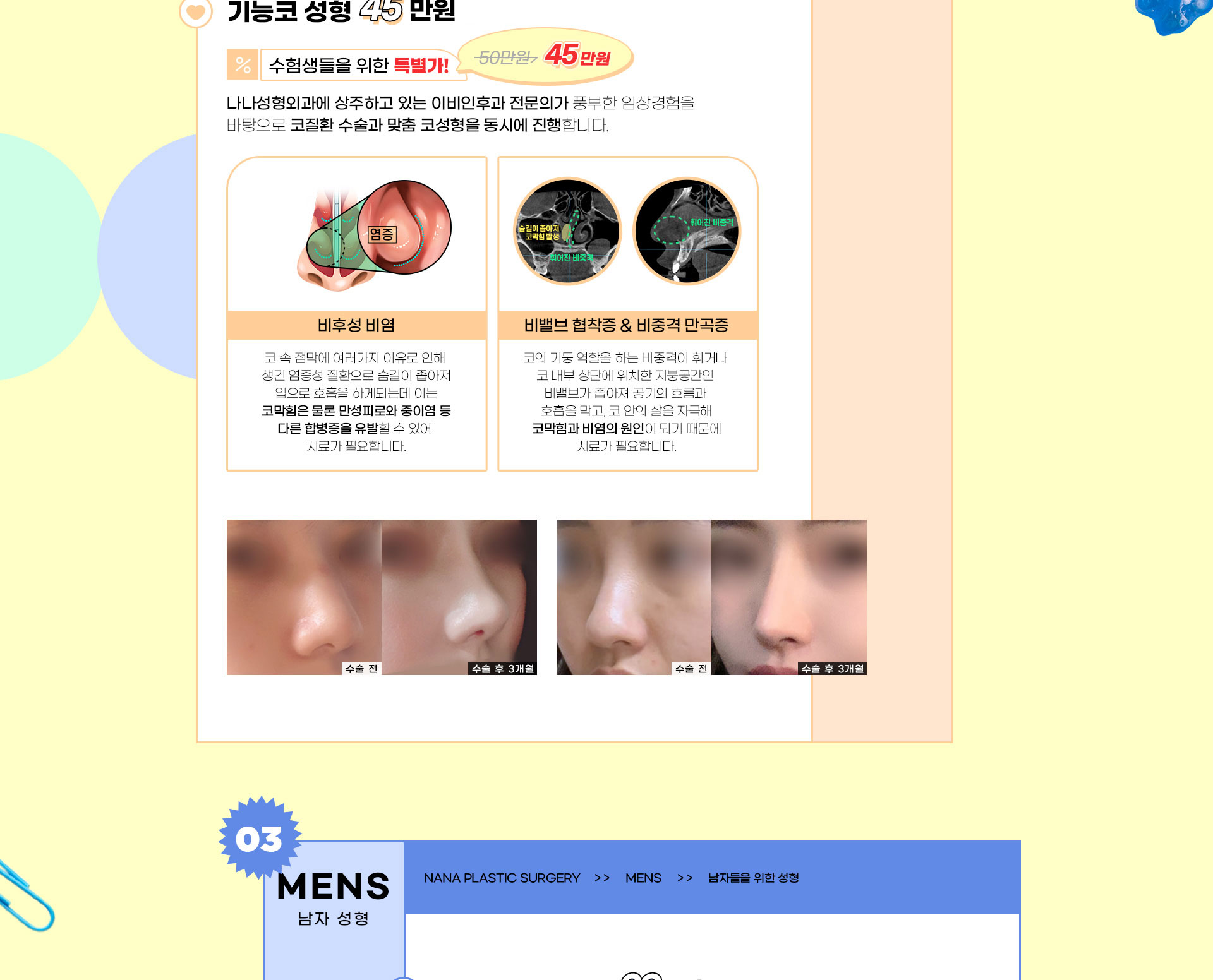 랜딩이미지