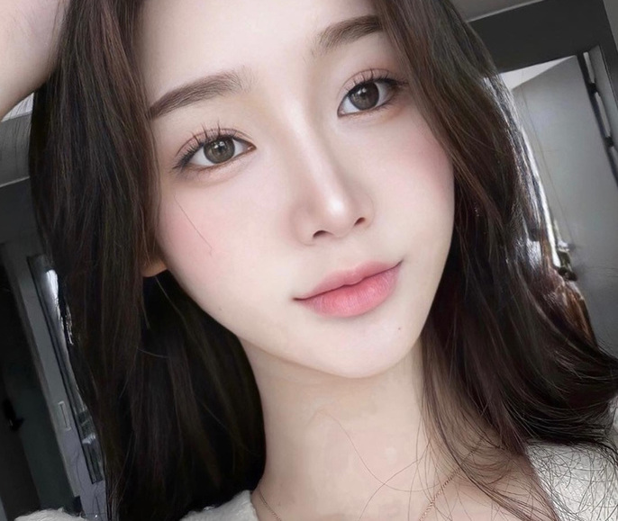 듀얼락 자연유착 쌍수